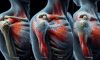 Acupuncture Techniques for Effective Frozen Shoulder Relief