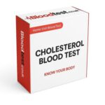 Cholesterol Blood Test: Essential Guide for Bath Residents